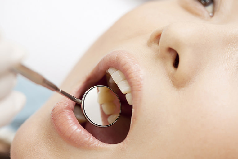立川の歯医者・歯科、くどう歯科クリニック(審美歯科・マウスピース矯正)の虫歯治療(むし歯)は何よりも痛くない、むし歯治療を心がけています。