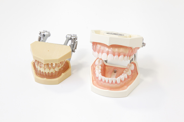 立川の歯医者・歯科、くどう歯科クリニック(審美歯科・マウスピース矯正)は虫歯治療(むし歯)の再発を防ぐために、歯肉の状態を改善してから歯型を取ります。
